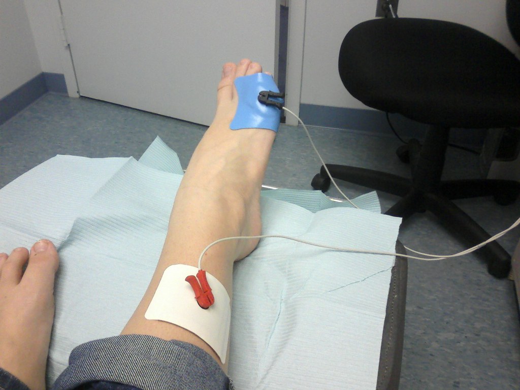 Fisioterapia deportiva — tratamiento de lesiones en atletas